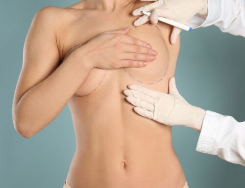 Todo lo que Necesitas Saber sobre el Aumento Mamario